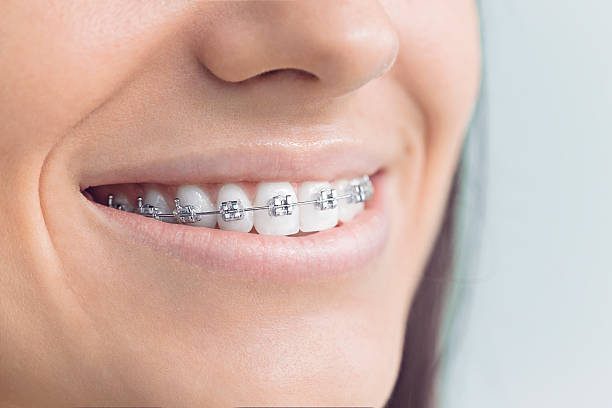 Best Wisdom Tooth Removal  in Redwater, TX